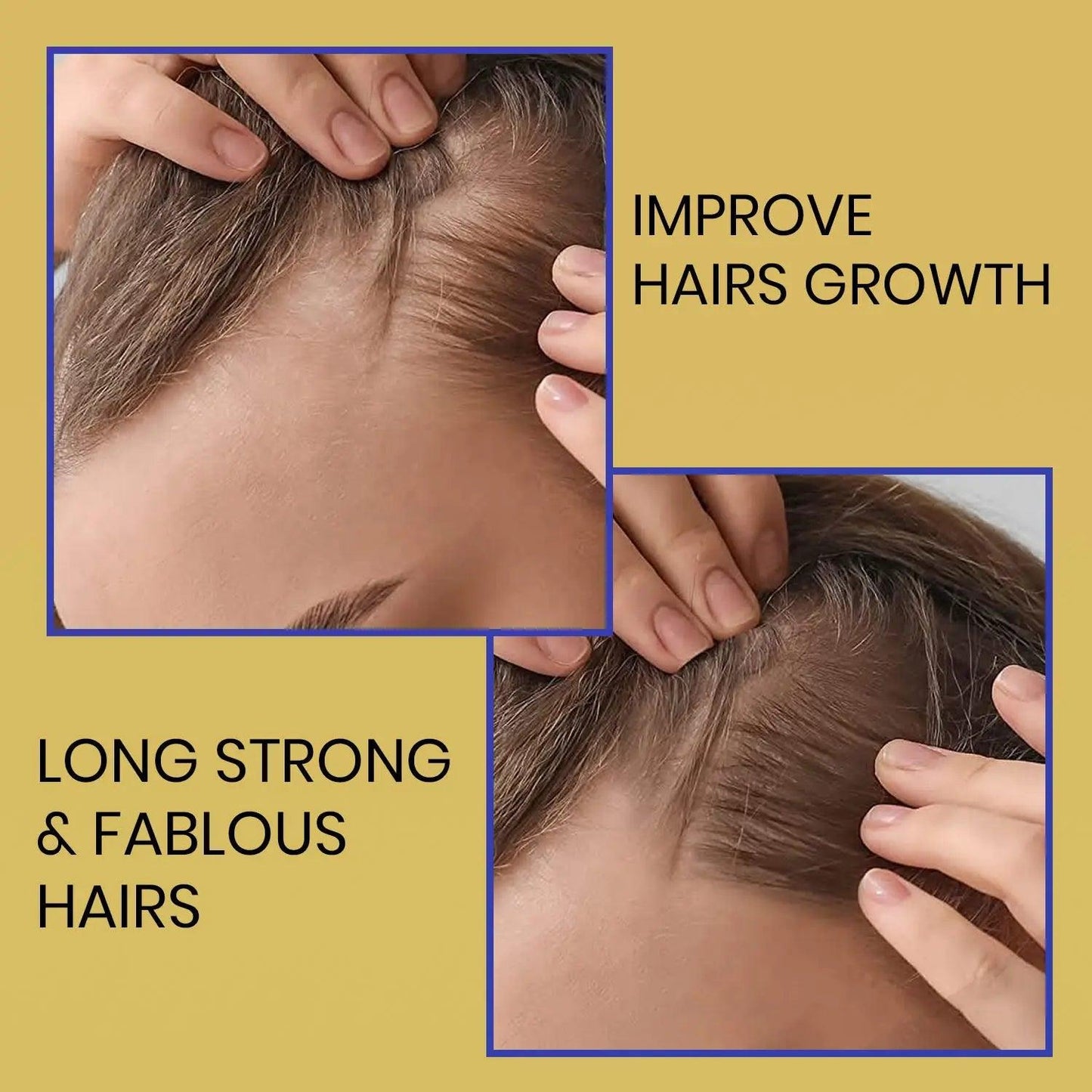 Ammuri Biotin Shampoo for Thicker Hair & Growth