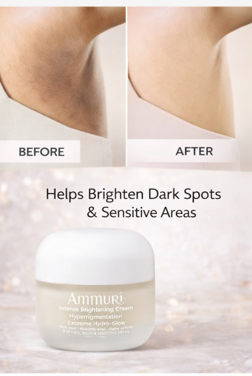 Ammuri Intense Skin Brightening Cream – Dark Spot & Pigmentation Corrector