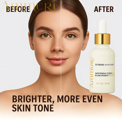 Ammuri Extreme Lightening Serum Premium Whitening Serum 30ml – Kojic Acid + Tranexamic Acid | Dark Spot & Pigmentation Corrector