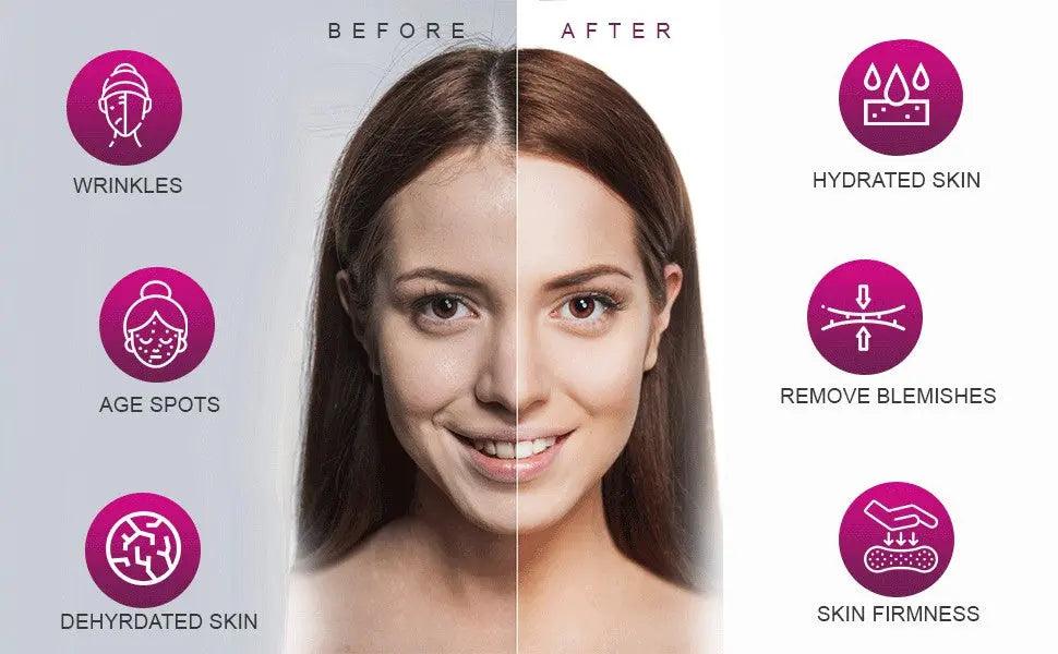 AmmuRi Age Reverse Serum – Advanced Botox Alternative Anti-Aging Formula – 30ml