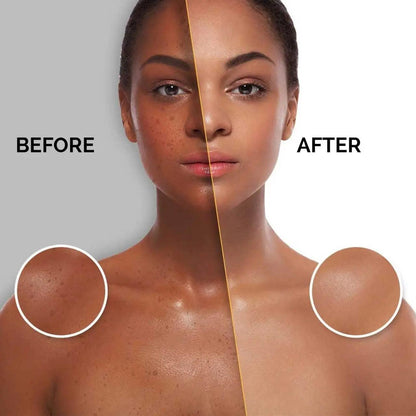 Ammuri Extreme Lightening Serum Premium Whitening Serum 30ml – Kojic Acid + Tranexamic Acid | Dark Spot & Pigmentation Corrector