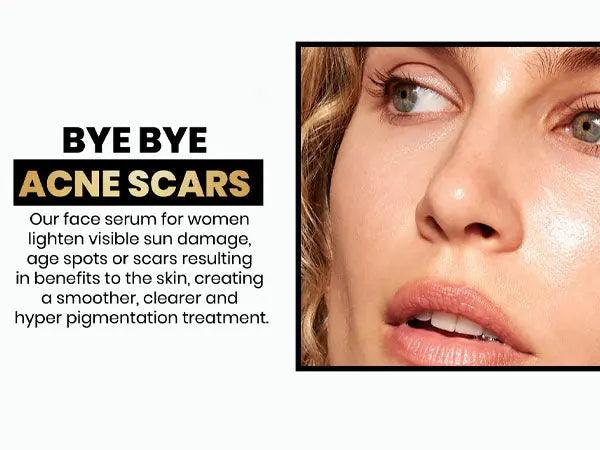 Ammuri Extreme Lightening Serum Premium Whitening Serum 30ml – Kojic Acid + Tranexamic Acid | Dark Spot & Pigmentation Corrector