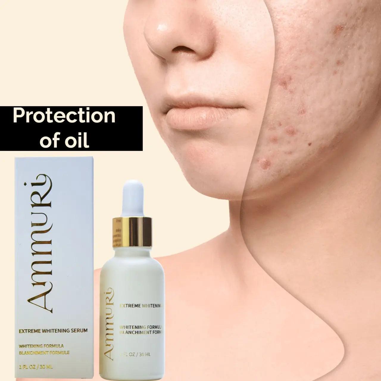 Ammuri Extreme Lightening Serum Premium Whitening Serum 30ml – Kojic Acid + Tranexamic Acid | Dark Spot & Pigmentation Corrector
