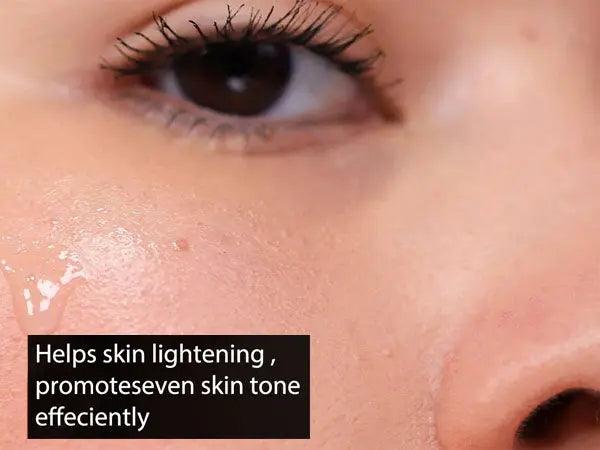 Ammuri Extreme Lightening Serum Premium Whitening Serum 30ml – Kojic Acid + Tranexamic Acid | Dark Spot & Pigmentation Corrector