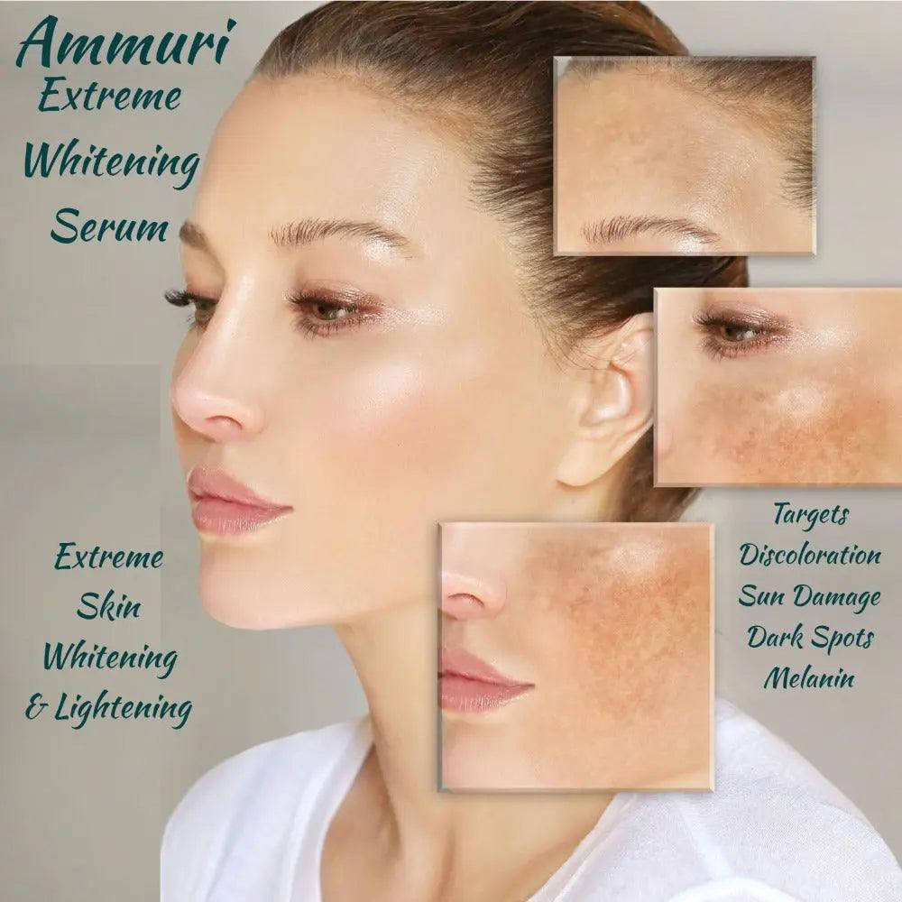 Ammuri Extreme Lightening Serum Premium Whitening Serum 30ml – Kojic Acid + Tranexamic Acid | Dark Spot & Pigmentation Corrector