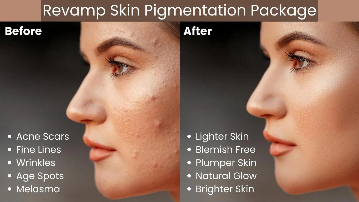 Ammuri Skincare Pigmentation Skincare Gift Set