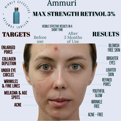 Ammuri Retinol 5% Serum for Anti-Ageing Skin Revitalization