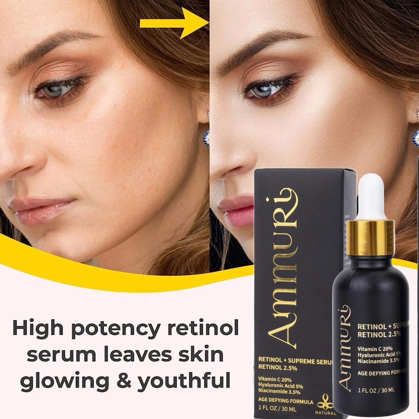 Ammuri Retinol Supreme Serum for Anti-Ageing Skin Care