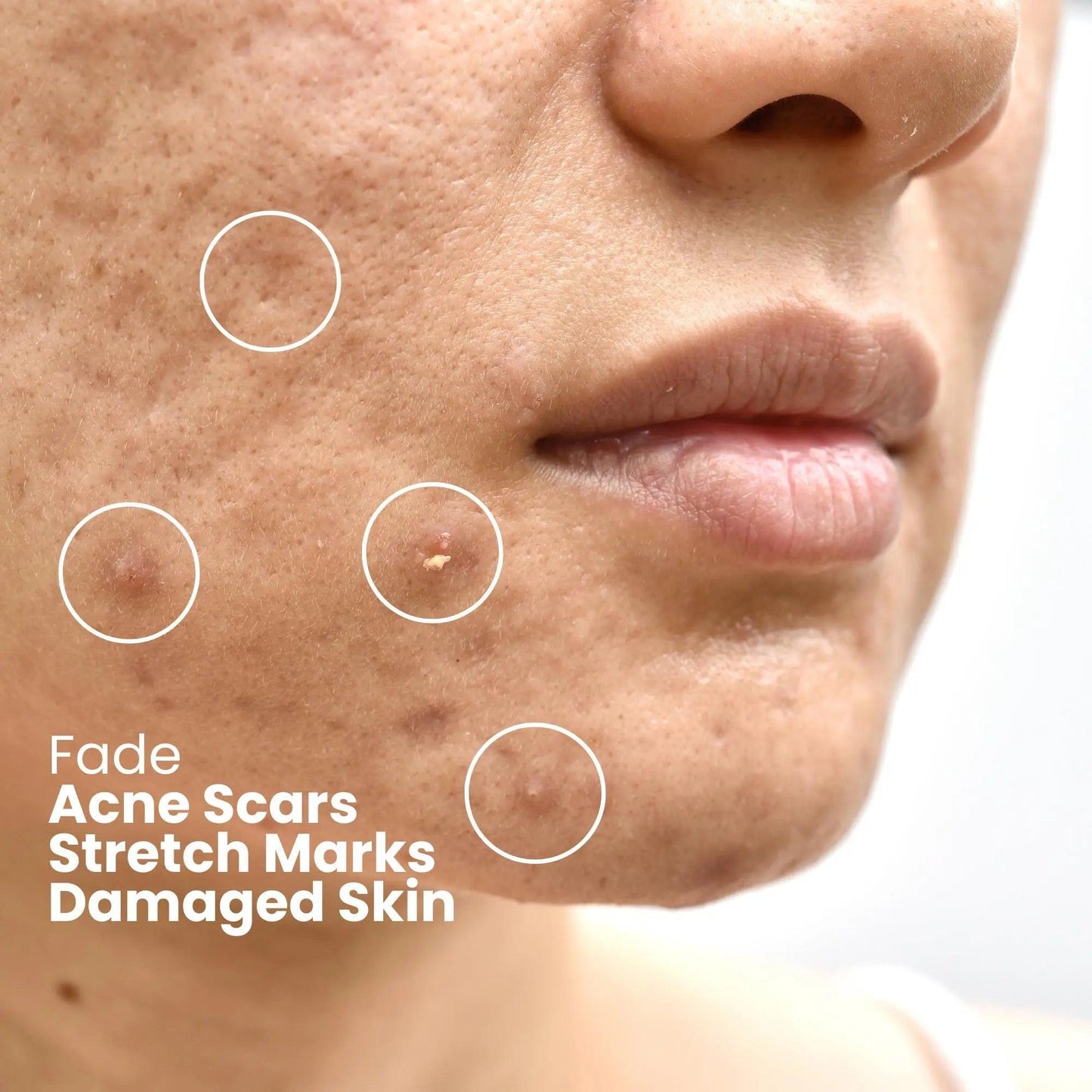 Ammuri Bioactive Snail Repair Serum Anti-Aging Organic