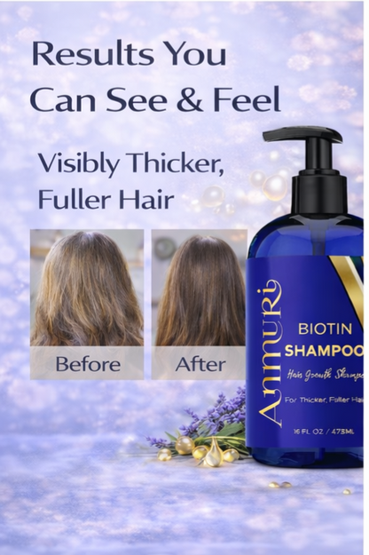 Ammuri Biotin Shampoo – DHT Blocker for Thicker, Fuller-Looking Hair | 473ml